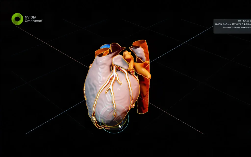 CoDoctor Corosegmentater